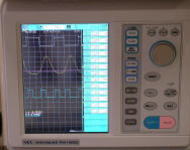 Respiratory Gating System