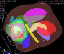 3D Dose Distribution Curves